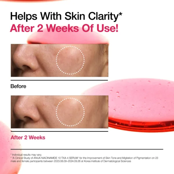ANUA NIACINAMIDE 10% + TXA 4% SERUM 30 ML