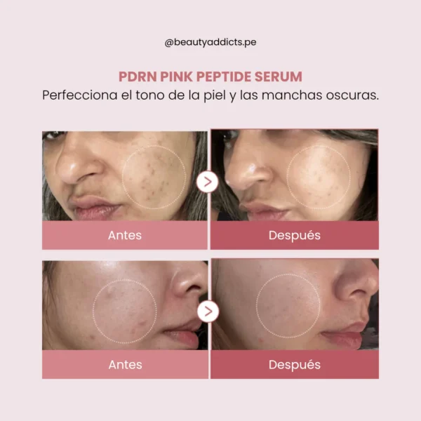 MEDICUBE PDRN PINK PEPTIDE SERUM